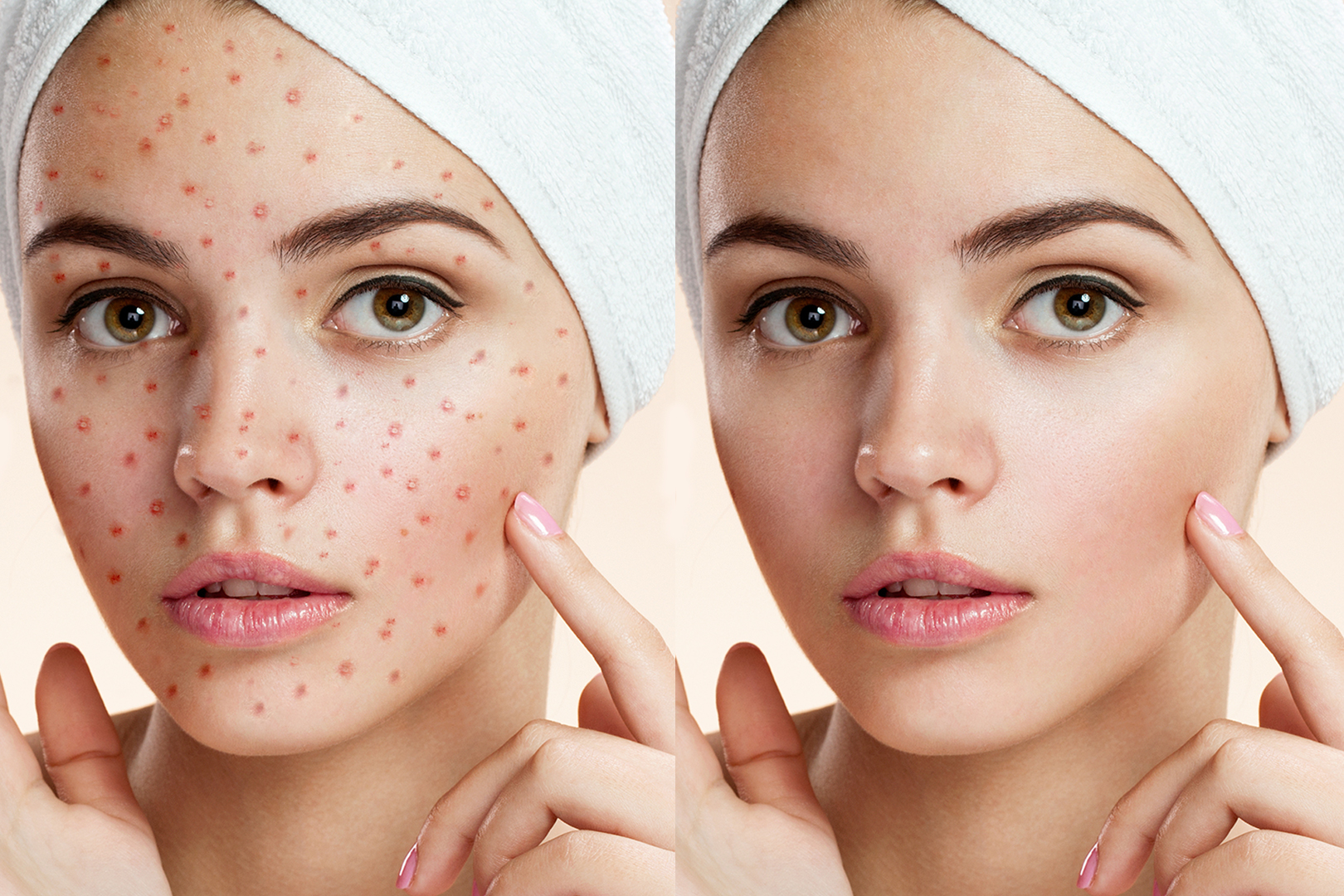 How To Make Clean Face Skin In Photoshop